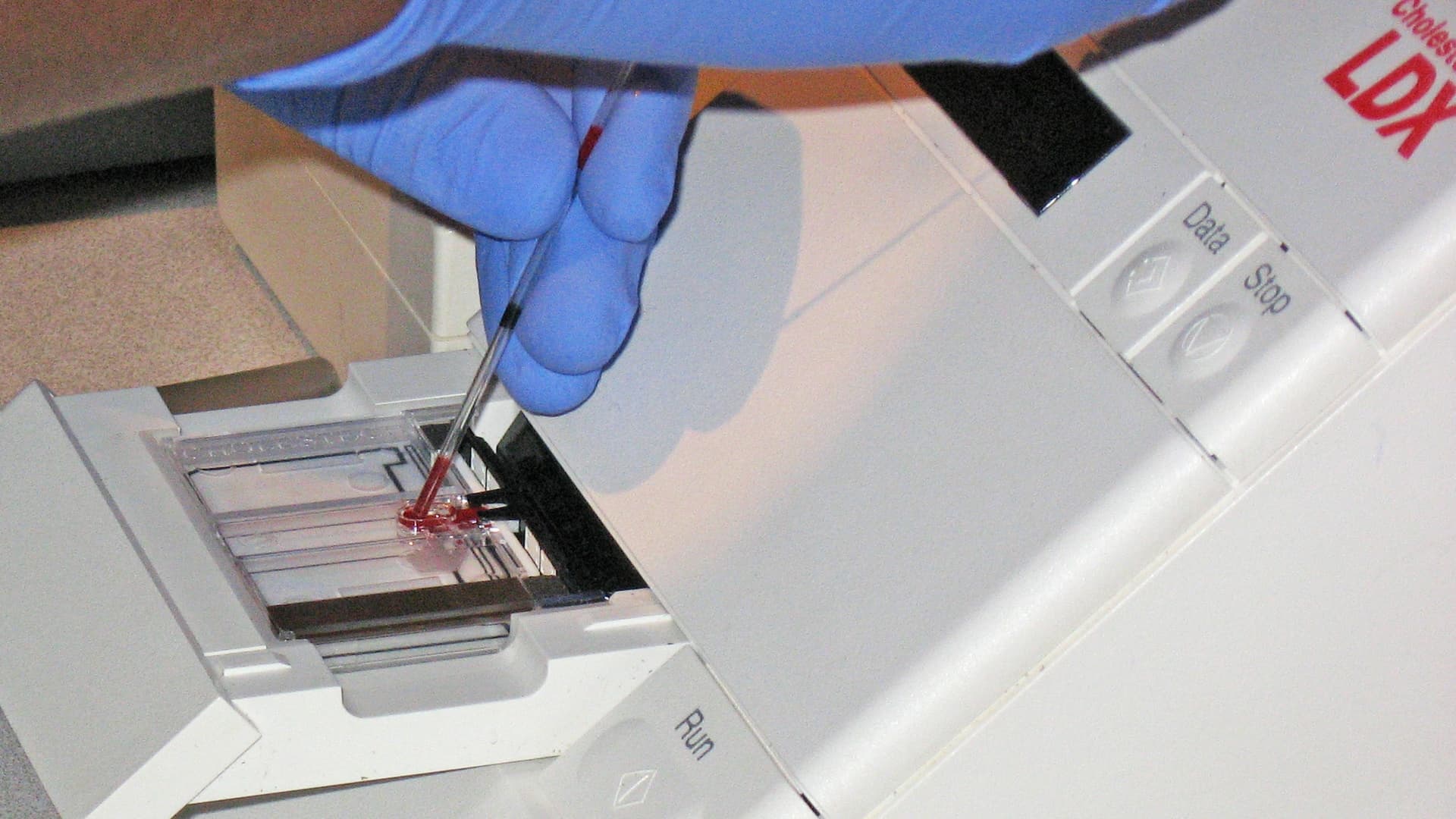 New initiative to help people with high cholesterol and associated cardiovascular disease