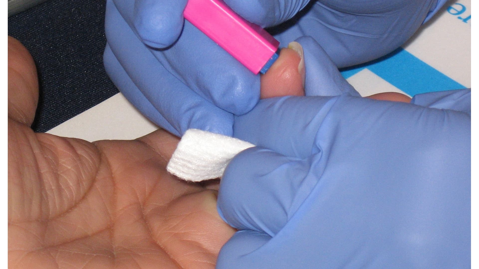 New study finds childhood abuse linked to higher risk for high cholesterol as an adult